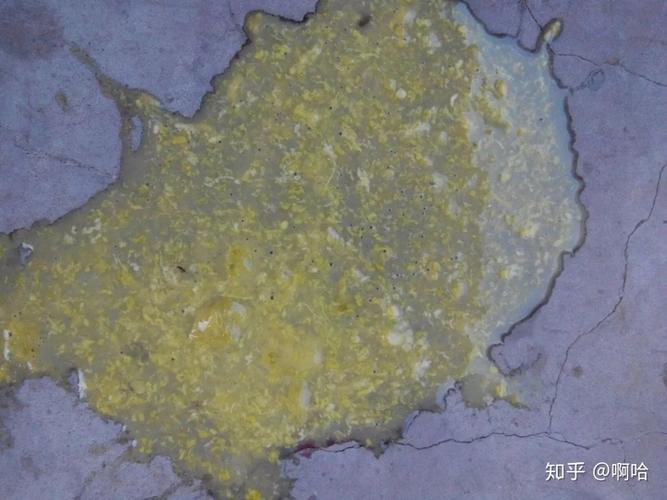 "闻"便识健康,宝宝各种大便图鉴,您一定要了解