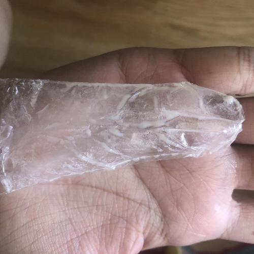 姐妹们帮看看白带这样正常吗有图慎入