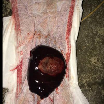 怀孕八周了,流了四天的血一直在吃保胎药,可昨晚起床上厕所有一坨东西