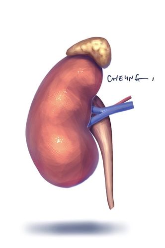 医学插画