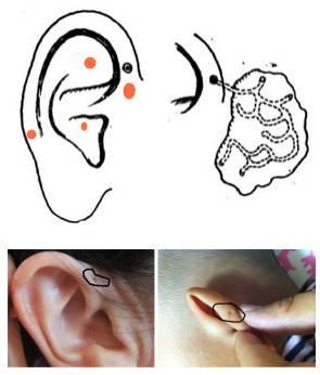 耳朵上的小洞洞是什么?