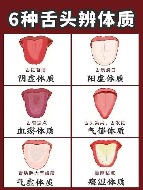 每天自己对照看看舌头的情况,会有利于我们发现身体的各种疾病,也能让
