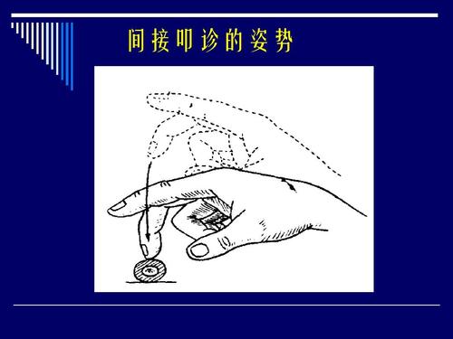 间接叩诊的姿势