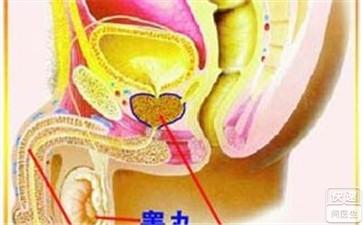 前列腺病自我按摩图解 前列腺炎的自我疗法技巧