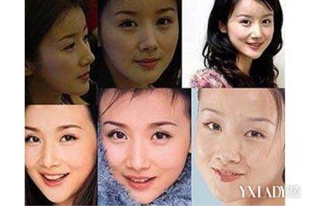 【图】曝光孙菲菲整容照片吓死人 揭秘明星的整容秘密