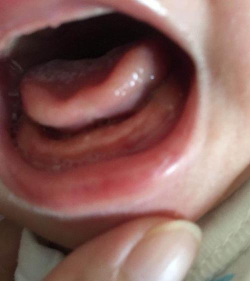 宝宝出牙早晚与什么有关?原因挺复杂,但有必要为孩子留意