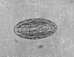 猪棘头虫成熟卵