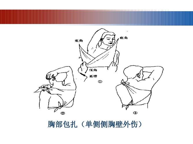止血包扎(教学)ppt