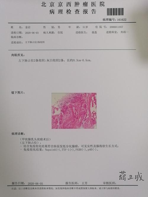 低分化肺腺癌最热贴_圈子 - 肺癌帮