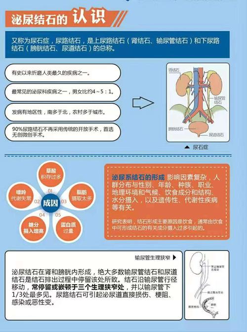 泌尿系结石小知识