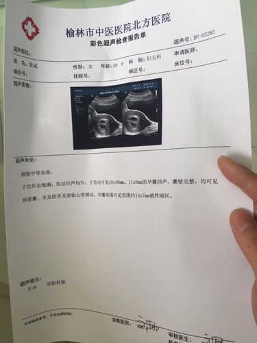 双胞胎6周多了,检查有液性暗区