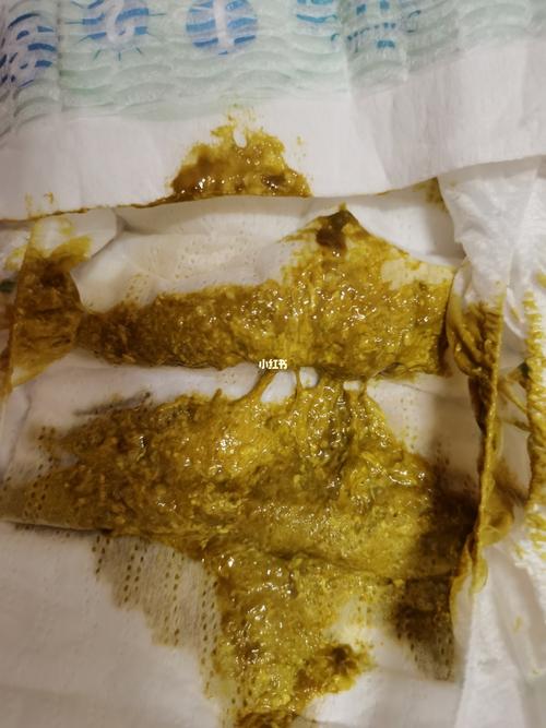 纽康特大便黄色奶瓣,知道的麻麻进来看看_康特怎么样