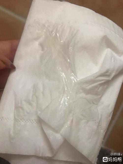 白带清澈透明拉丝