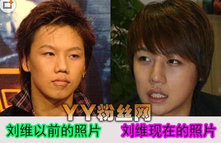 刘维整容前后照片真恶心 声音太娘被质疑是不是同性恋