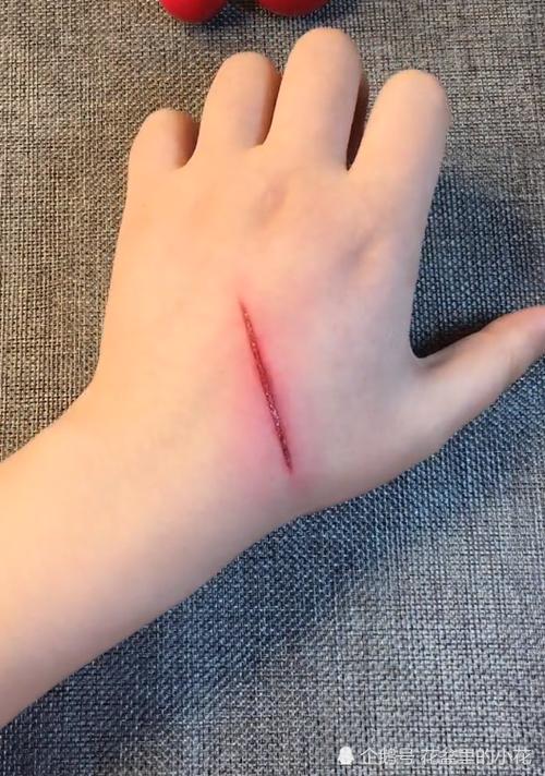 美术生想偷懒,画个伤口来请假,看到效果:老师都认不出来