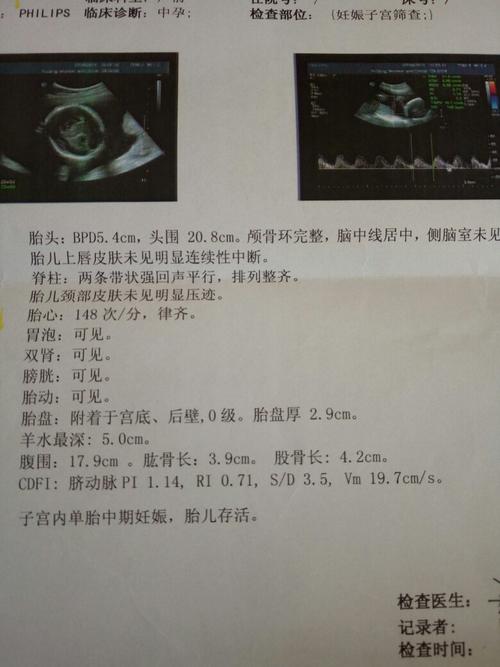 33333  满意回答 你好根据你的b超检查结果显示胎儿发育基本符合孕周