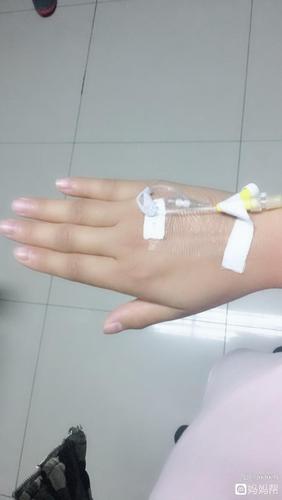 输液手都输成猪蹄了