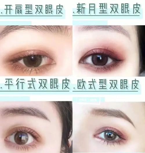 几种双眼皮类型,哪一种更适合你71_双眼皮_全切双眼皮_双眼皮手术