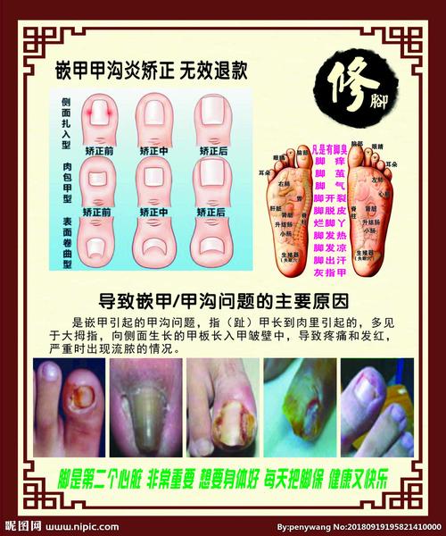 修脚图片