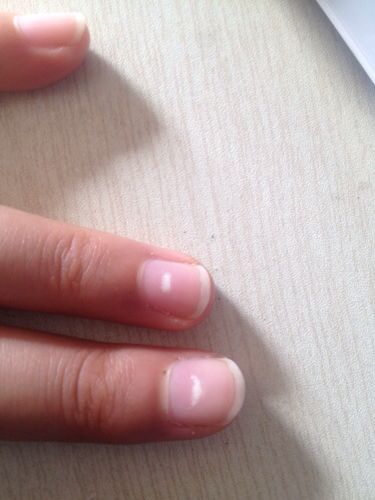 指甲里面长了白点点,怎么回事