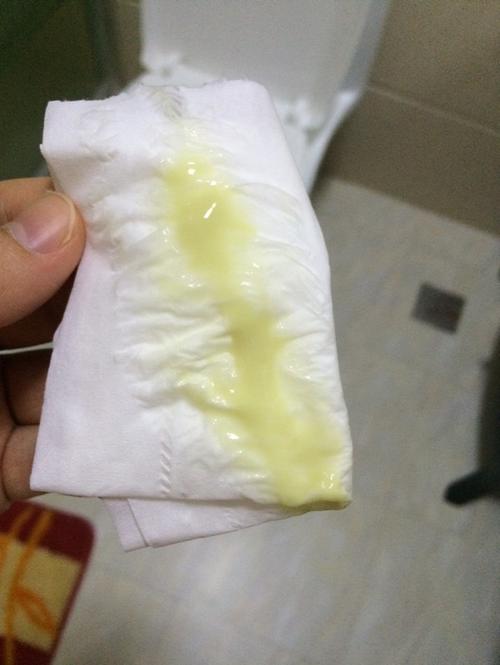 孕晚期分泌物?