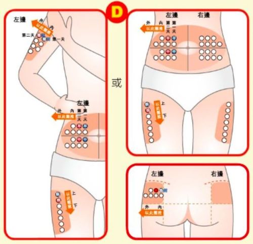 为什么我按时打胰岛素,怎么血糖还不稳定呢?