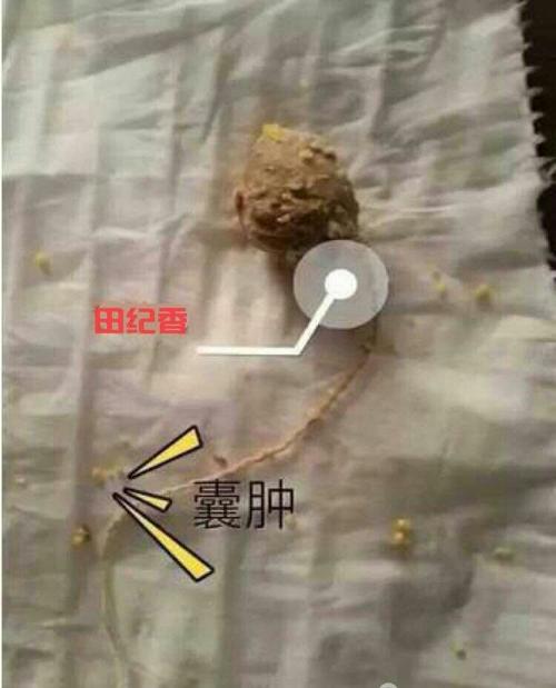囊肿一般小而分散,可突出于子宫颈表面.