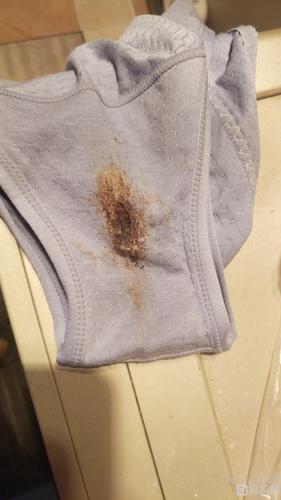 有褐色分泌物,有点怕怕的,不知道是不是之