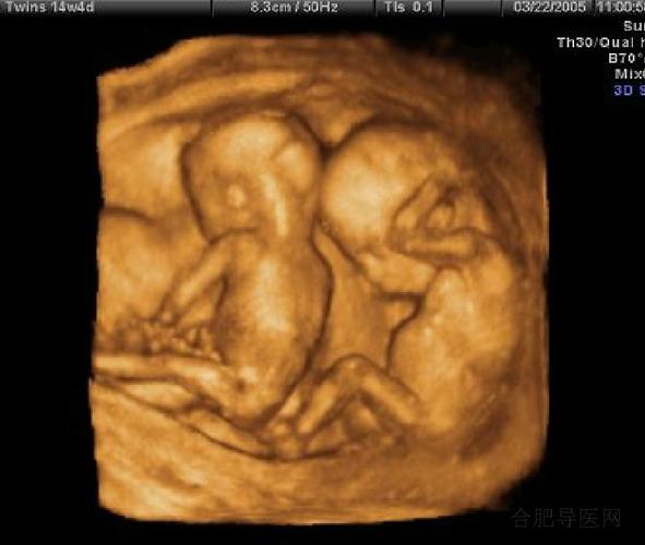 四维彩超;; 10周胎儿四维彩超;  四维b超>官方网站-免费做四维彩超