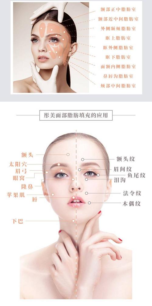 北京面部脂肪填充单部位 拍单送满额赠 报车费高返现2千 脂肪填充额头