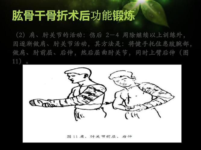 肱骨干骨折术后功能锻炼 (2)肩,肘关节的活动:伤后 2-4 周除继续以上