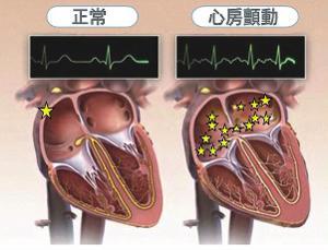 不快,可无明显症状,如心率快,患者诉心悸,心慌,胸闷,气短,心脏乱跳