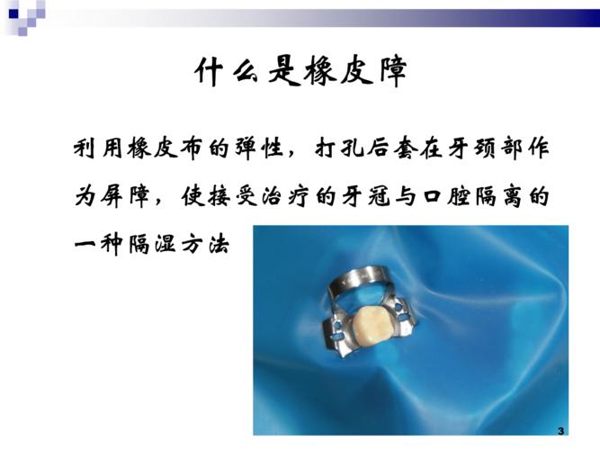 2橡皮障的应用技术方案.ppt 38页