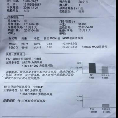 唐氏筛查为高风险 21·三体综合症征风险值1:188 ,hcg