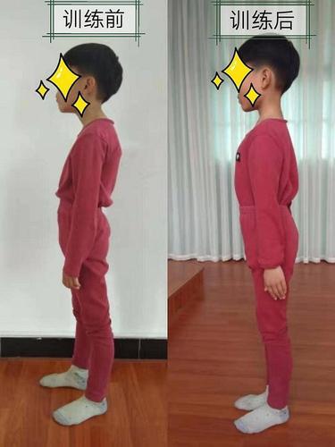 儿童(6-12岁)体态测评,仅限38个名额(公益免费)