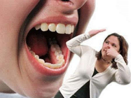 口臭都是浮云 口臭的两大秘密 拿走不谢!