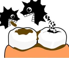 蛀牙牙疼,又因受风加剧牙疼,怎么办