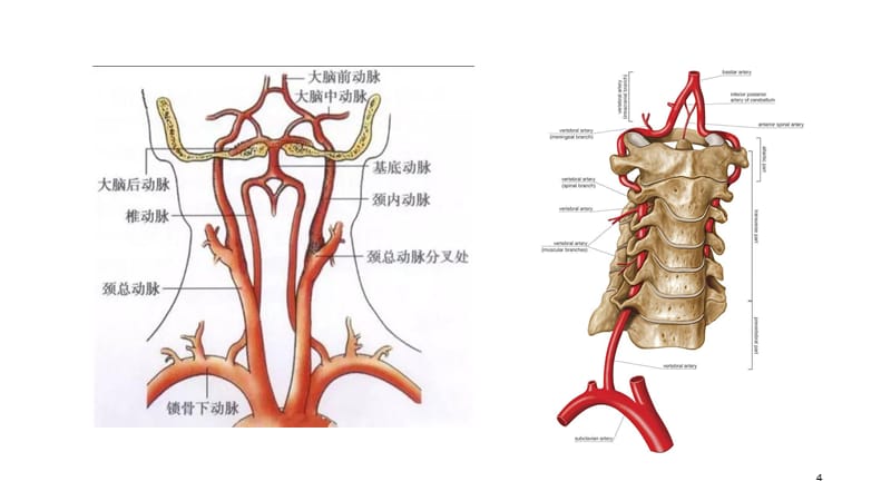 椎动脉发育不良ppt演示幻灯片