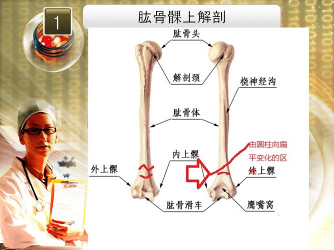 肱骨髁上骨折护理