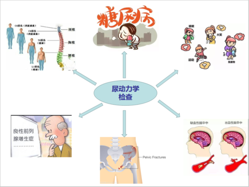 尿动力学检查都查点啥?