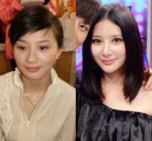 熊乃瑾个人资料熊乃瑾整容前熊乃瑾老公熊乃瑾身高熊乃瑾微博熊乃瑾