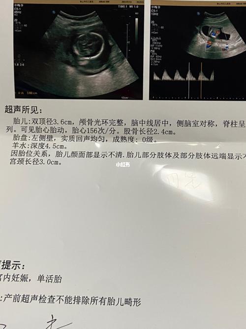 孕17周77胎盘上涨了_胎盘_母婴_孕产经验