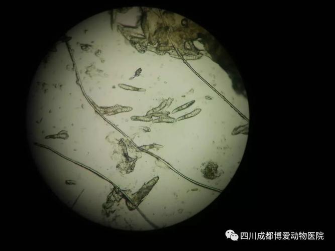 【病例分享】蠕形螨