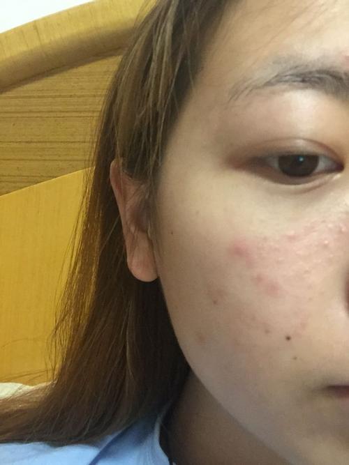 脸上长这样子的.