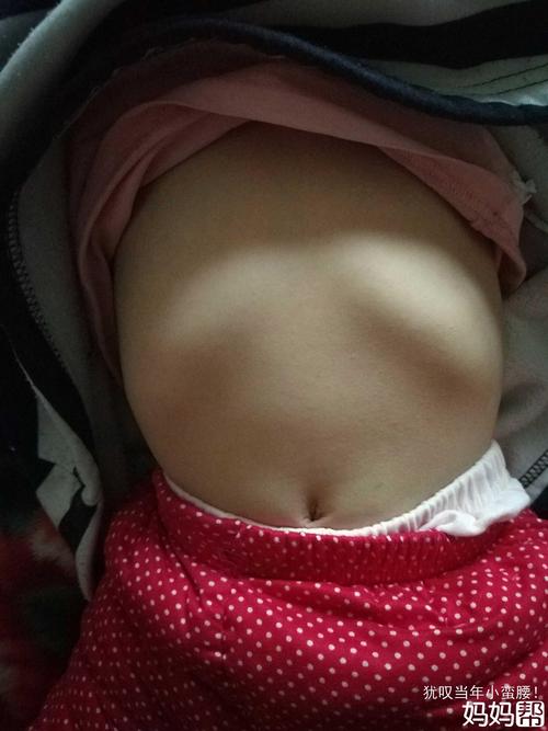 宝宝肋骨是不是外翻啊?