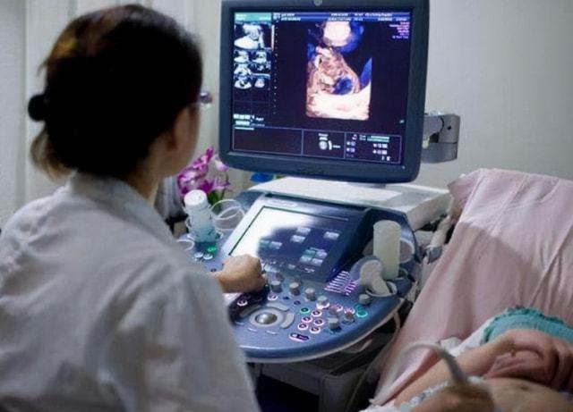 什么是阴式b超别不好意思其实这4类人或许不太适合做