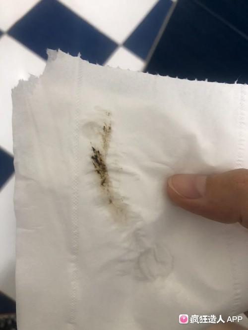 [试管婴儿]孕早期黑色渣渣 (有图慎入)