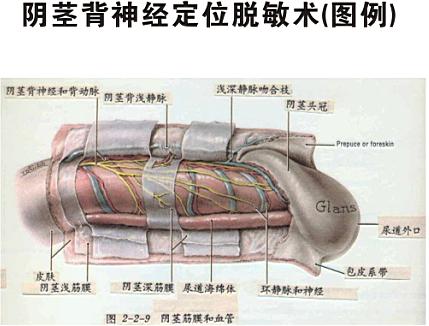 阴茎背神经阻断术