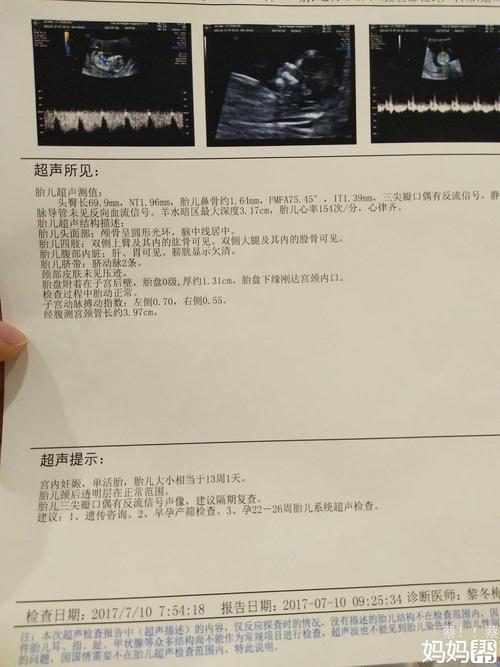 nt三尖瓣口偶有反流信号!