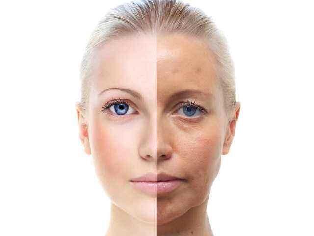 皮肤暗沉发黄怎么办?